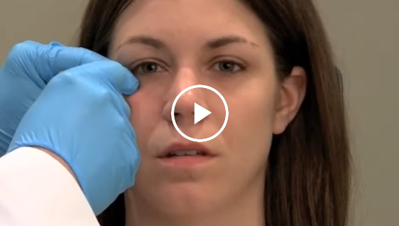 Restyalne Injection with a Cannula For Under-Eye Bags