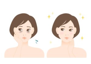 Can You Permanently Remove Dark Circles? | McCracken Blog