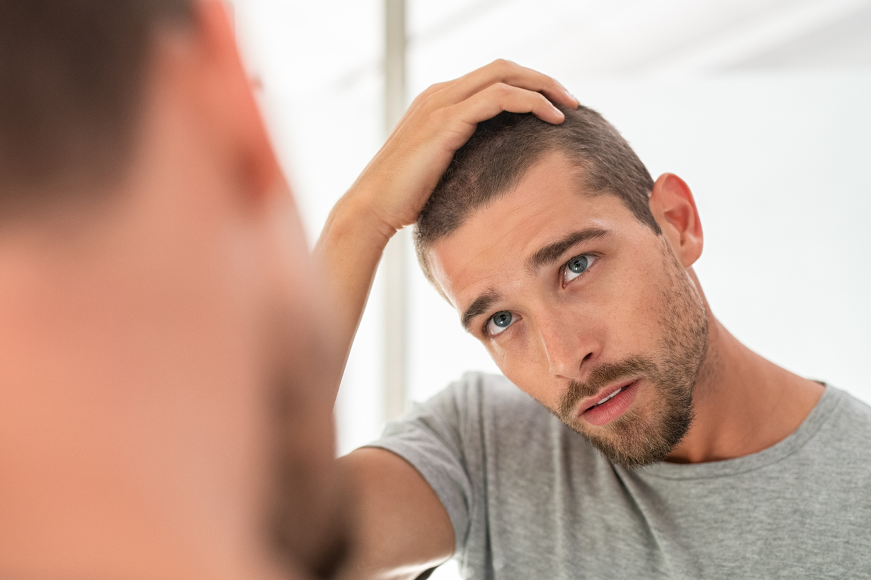 Man looking at causes of hair loss.
