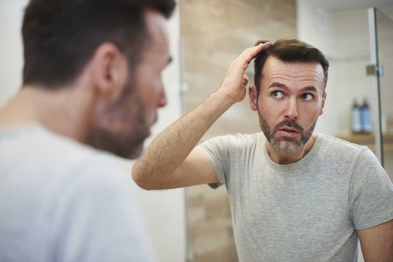 Does hair loss make you look old?