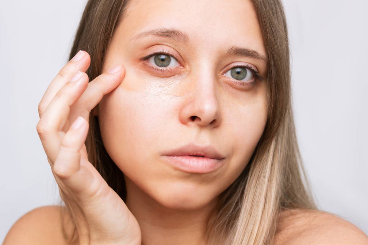 featured image for article about top myths about treating dark circles