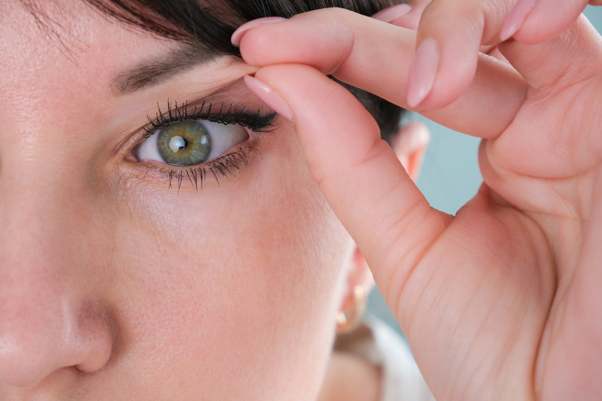Featured image for What Is the Most Common Cause of Dermatochalasis